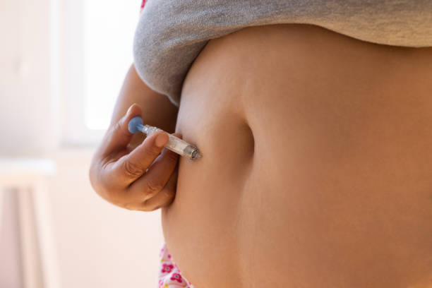 femme faisant la démonstration de l’injection - pcos (polycystic ovary syndrome) photos et images de collection